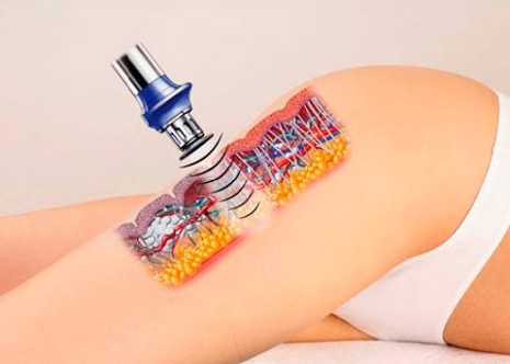 покращенaня кровообігу