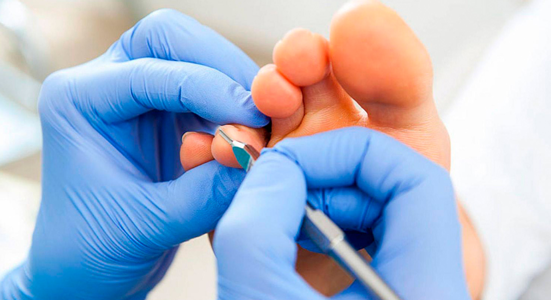 консультація подолога