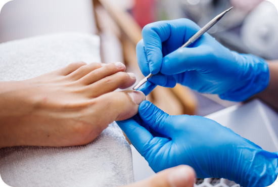 медичний педікюр