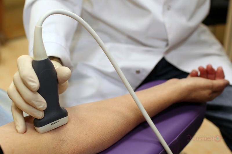 УЗД судин верхніх і нижніх кінцівок