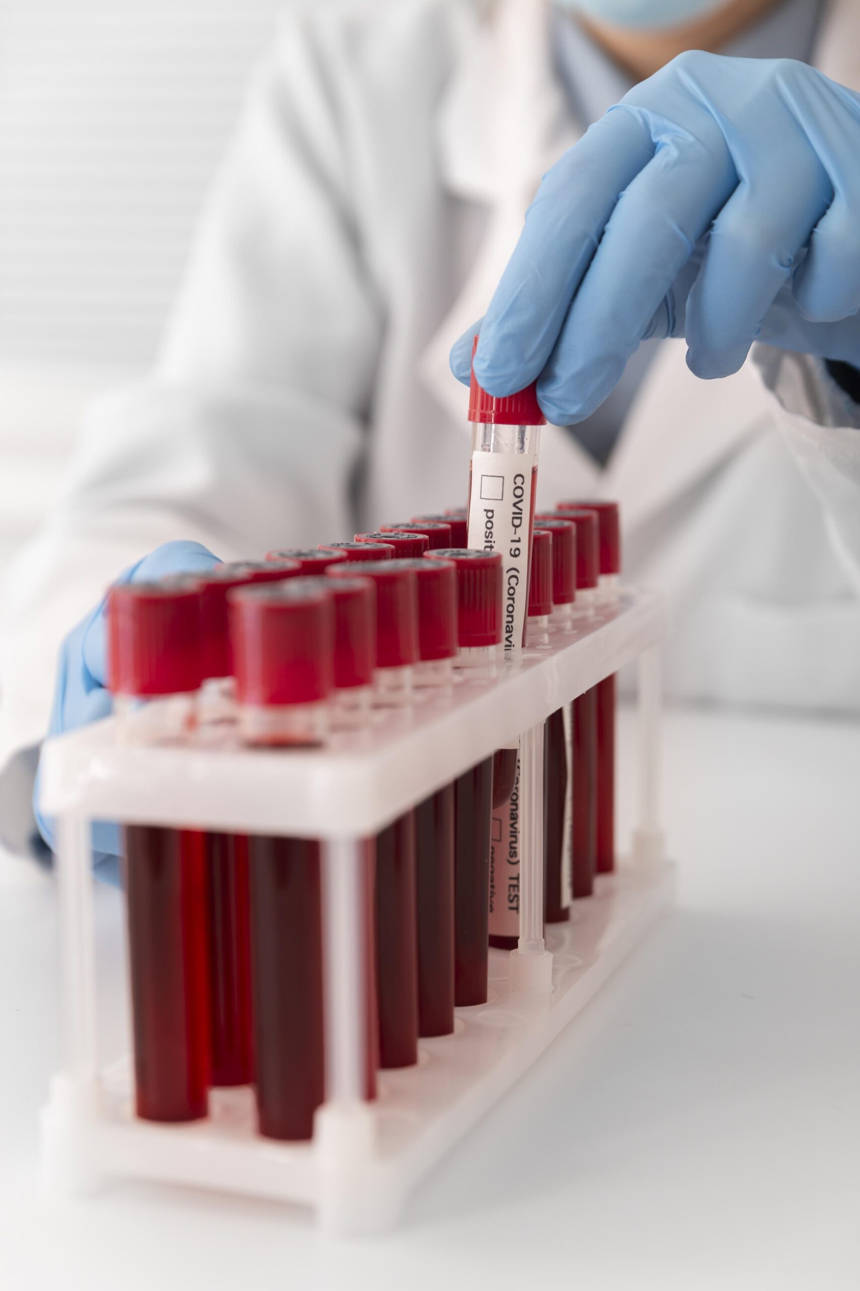 Біохімічний аналіз крові