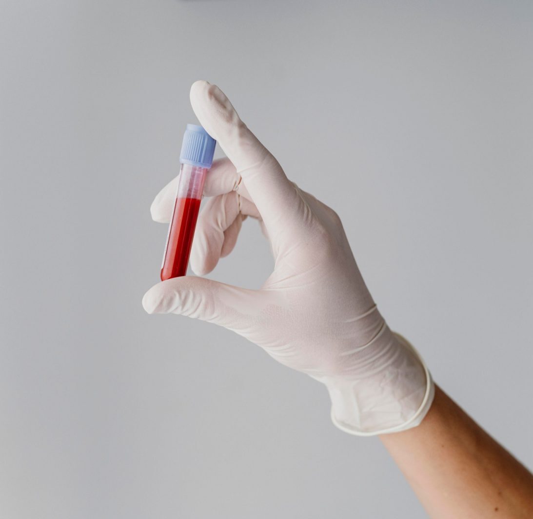 Гормональні аналізи