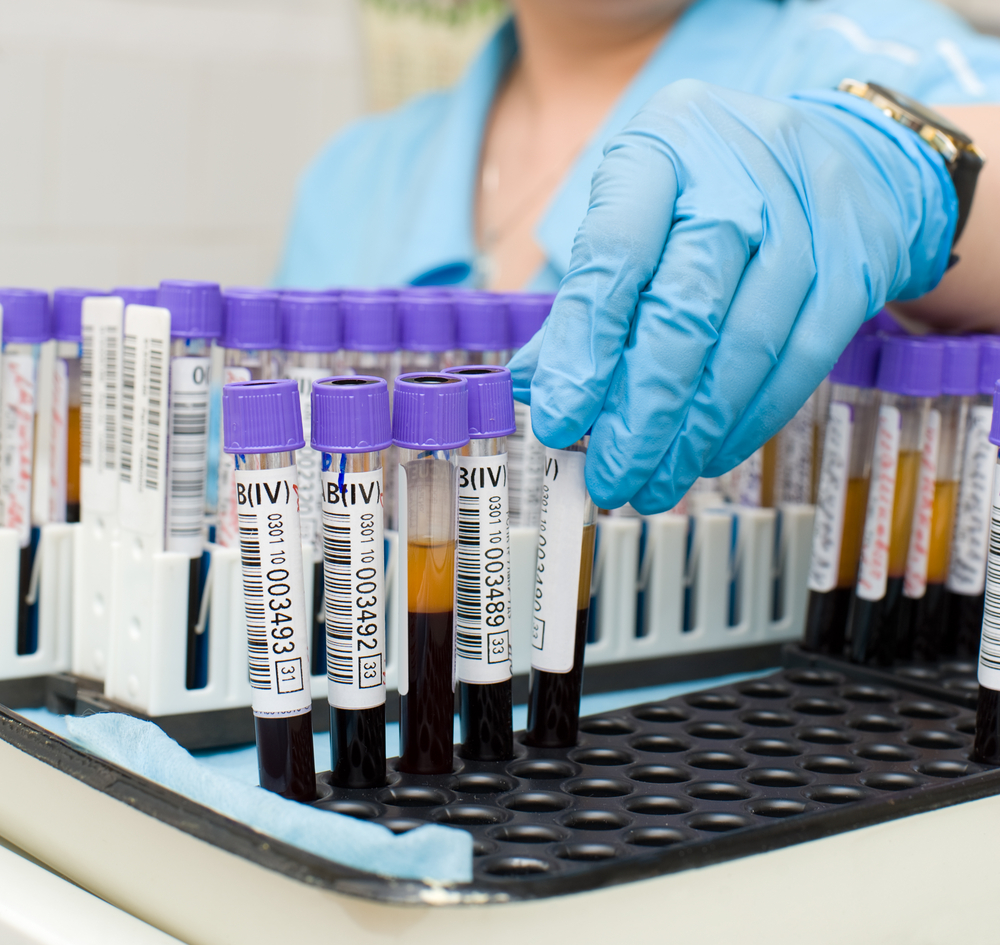 Аналіз крові на алергени (IgE)