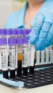 Аналіз крові на алергени (IgE)