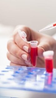 Аналізи на інфекції