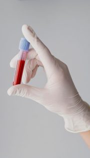 Гормональні аналізи