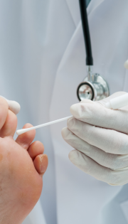 Лікування грибка нігтів