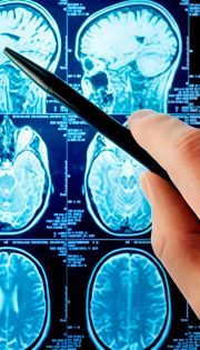 Інтерпретація-результатів-МРТ-головного-мозку-та-хребта