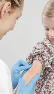 Консультація дитячого алерголога