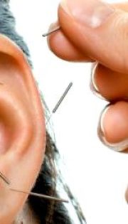 Рефлексотерапія рук і вух