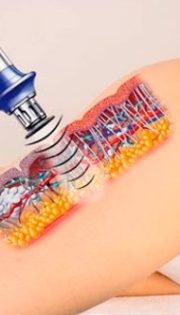 покращенaня кровообігу