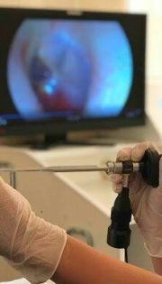 Проведення ендоскопічної діагностики