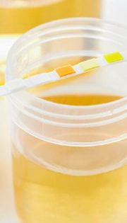 Лабораторні аналізи сечі та крові