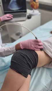 УЗД нирок та сечового міхура