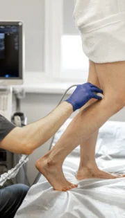 УЗД судин верхніх і нижніх кінцівок