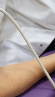 УЗД судин верхніх і нижніх кінцівок